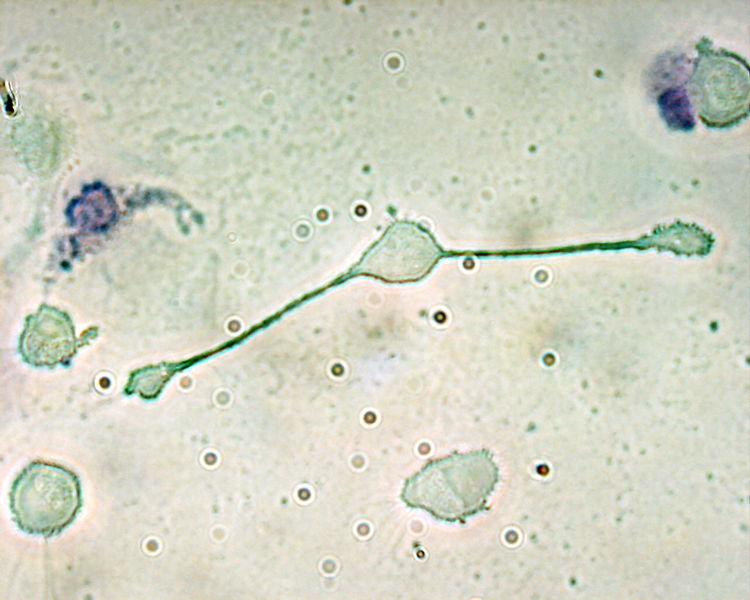 Soubor:Macrophage.jpg