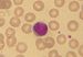 Lymphocyte2.jpg