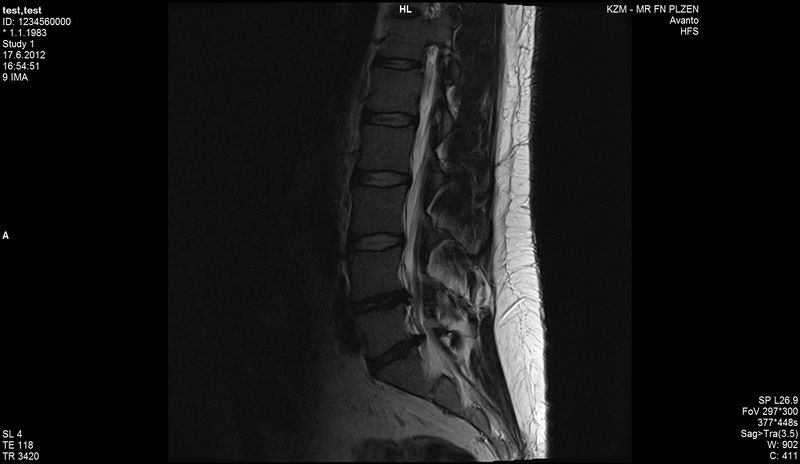 Soubor:Magnetická rezonance bederní páteře.jpg